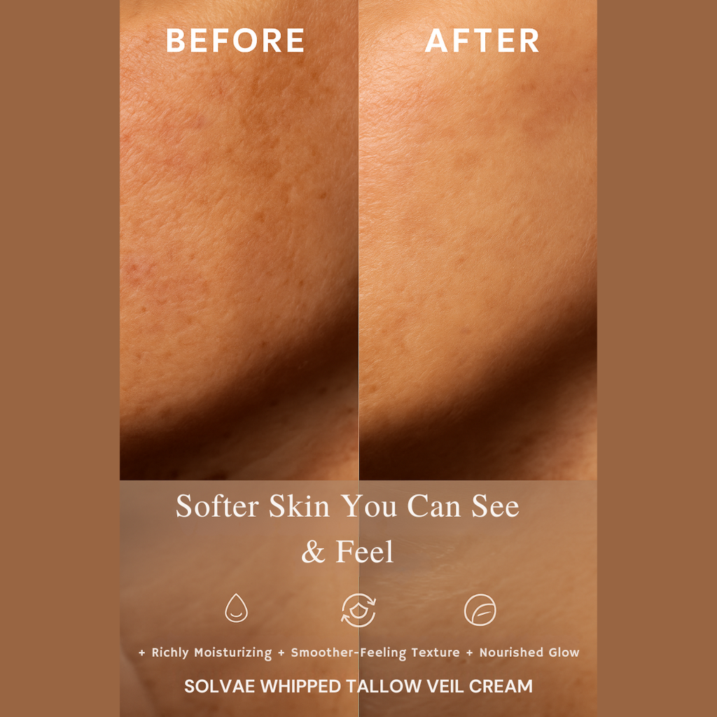 Whipped Tallow Barrier Cream | Repair Cream with Squalene, Jojoba, Ceramides & Vitamin E